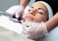 Microneedling Treatment