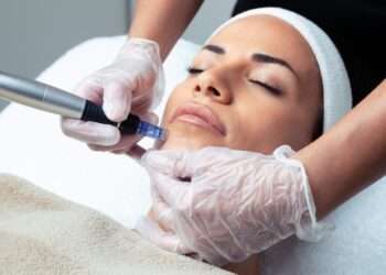 Microneedling Treatment